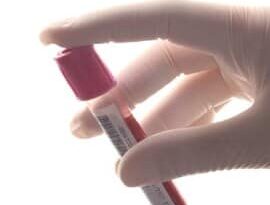 When “Normal” Lab Results Don’t Match How a Woman Feels